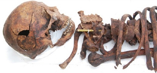 2012년 개관 시 드러난 선생의 해골은 함몰돼 있다. 기념사업회 제공